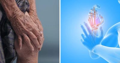 ¿La terapia con células madre para tratar dolores articulares podría destronar la terapia tradicional?